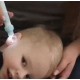 Vákuový čistič a odstraňovač ušného mazu C-ears